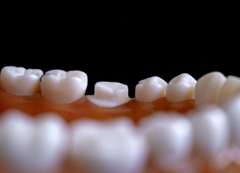Orthodontic Challenges