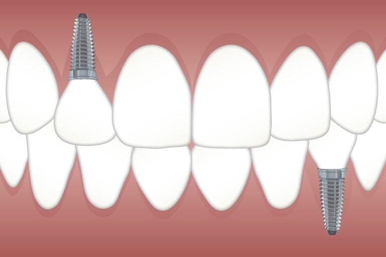 Role Of Periodontists