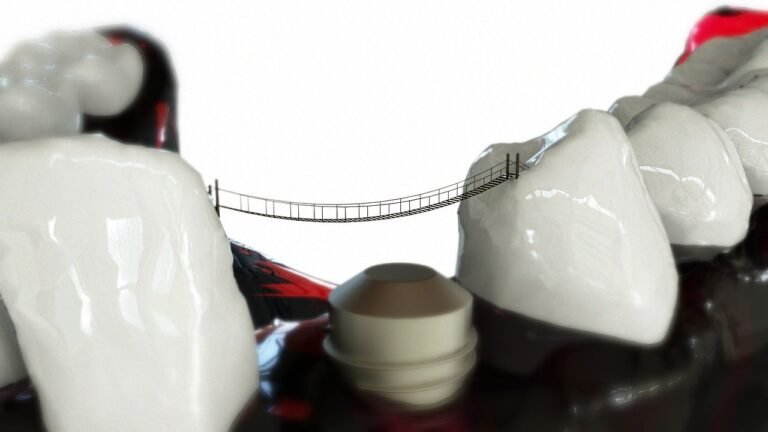Dentures Or Bridges